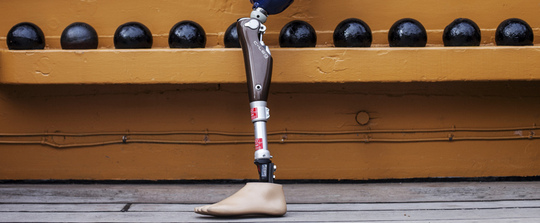 NHS patients denied funding for advanced microprocessor prosthetic knees